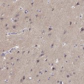 Anti-TMEM145 antibody produced in rabbit Prestige Antibodies® Powered by Atlas Antibodies, affinity isolated antibody