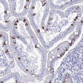 Anti-RNF186 antibody produced in rabbit Prestige Antibodies® Powered by Atlas Antibodies, affinity isolated antibody, buffered aqueous glycerol solution