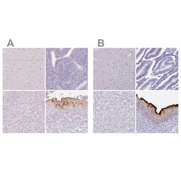 Anti-UPK2 antibody produced in rabbit Prestige Antibodies&#174; Powered by Atlas Antibodies, affinity isolated antibody, buffered aqueous glycerol solution