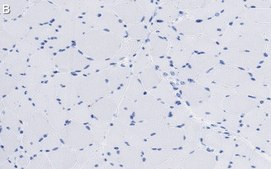 Anti-p38γ MAPK Antibody, clone 1N13 ZooMAb® Rabbit Monoclonal recombinant, expressed in HEK 293 cells