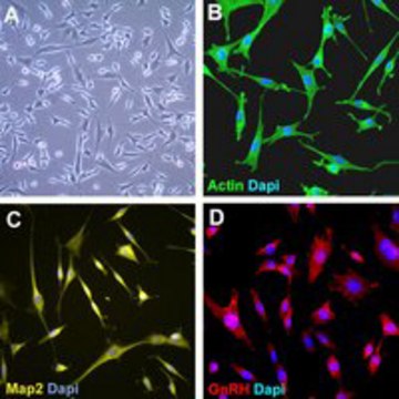 GN11 Mouse GnRH Neuronal Cell Line The GN11 mouse neuronal cell line is an immortalized cell line established as a model of GnRH-secreting neurons.