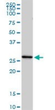 Anti-C1QC antibody produced in rabbit purified immunoglobulin, buffered aqueous solution