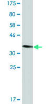 Monoclonal Anti-TTF2 antibody produced in mouse clone 1E4, ascites fluid, solution