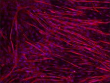 Anti-Dysferlin (N-terminal) antibody produced in rabbit ~1.0 mg/mL, affinity isolated antibody, antigen mol wt ~250 kDa