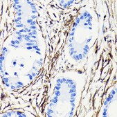 Anti- Vimentin antibody produced in rabbit
