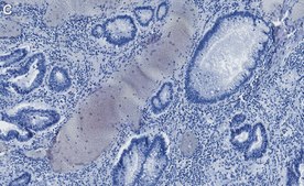 Anti-Phospho-IRF-3-(Ser396) Antibody, clone 2M20 ZooMAb® Rabbit Monoclonal recombinant, expressed in HEK 293 cells