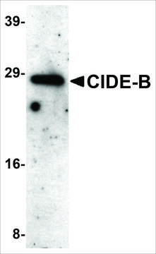 Anti-CIDE-B (ab3) antibody produced in rabbit affinity isolated antibody, buffered aqueous solution