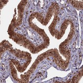 Anti-HIF3A antibody produced in rabbit Prestige Antibodies® Powered by Atlas Antibodies, affinity isolated antibody, buffered aqueous glycerol solution