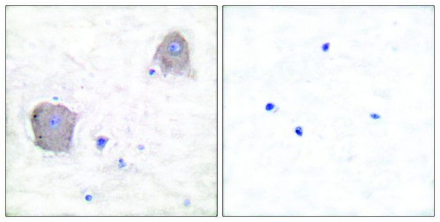 Anti-MGLUR4 antibody produced in rabbit affinity isolated antibody