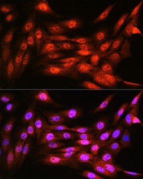 Anti-VCP antibody produced in rabbit