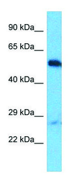 Anti-OTUD1 (C-terminal) antibody produced in rabbit affinity isolated antibody