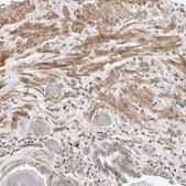 Anti-STXBP3 antibody produced in rabbit Prestige Antibodies® Powered by Atlas Antibodies, affinity isolated antibody, buffered aqueous glycerol solution