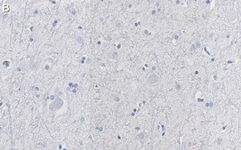 Anti-CNTNAP2 Antibody, clone 2D17 ZooMAb® Rabbit Monoclonal recombinant, expressed in HEK 293 cells