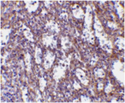 Anti-IL-32 Antibody from rabbit, purified by affinity chromatography