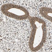 Anti-PNCK antibody produced in rabbit Prestige Antibodies® Powered by Atlas Antibodies, affinity isolated antibody, buffered aqueous glycerol solution