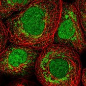 Anti-ZMAT2 antibody produced in rabbit Prestige Antibodies® Powered by Atlas Antibodies, affinity isolated antibody, buffered aqueous glycerol solution