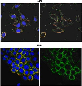 Anti-PORCN Antibody, clone 15G12.1 clone 15G12.1, from mouse