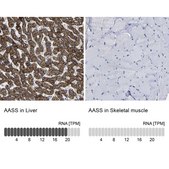 Anti-AASS antibody produced in rabbit Prestige Antibodies® Powered by Atlas Antibodies, affinity isolated antibody, buffered aqueous glycerol solution, Ab1