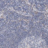 Anti-AGXT2 antibody produced in rabbit Prestige Antibodies® Powered by Atlas Antibodies, affinity isolated antibody, buffered aqueous glycerol solution
