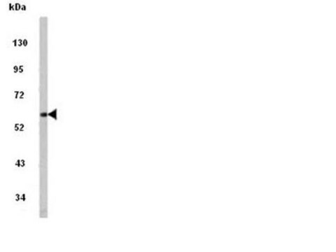 Anti-PACSIN1 Antibody, NT from rabbit