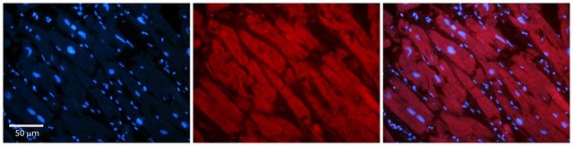 Anti-ASPH, (N-terminal) antibody produced in rabbit affinity isolated antibody