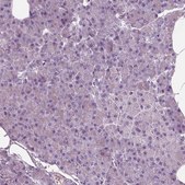 Anti-DPYSL5 antibody produced in rabbit Prestige Antibodies® Powered by Atlas Antibodies, affinity isolated antibody, buffered aqueous glycerol solution