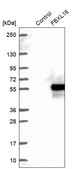 Anti-FBXL16 antibody produced in rabbit Prestige Antibodies® Powered by Atlas Antibodies, affinity isolated antibody, buffered aqueous glycerol solution