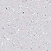 Anti-DMKN antibody produced in rabbit Prestige Antibodies® Powered by Atlas Antibodies, affinity isolated antibody, buffered aqueous glycerol solution