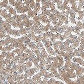 Anti-PRDX1 antibody produced in rabbit Prestige Antibodies&#174; Powered by Atlas Antibodies, affinity isolated antibody, buffered aqueous glycerol solution