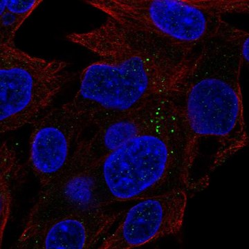 Anti-Acy1 Antibody Produced In Rabbit Prestige Antibodies&#174; Powered by Atlas Antibodies, affinity isolated antibody, buffered aqueous glycerol solution