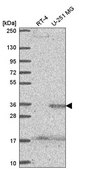 Anti-SPRY4 antibody produced in rabbit Prestige Antibodies® Powered by Atlas Antibodies, affinity isolated antibody