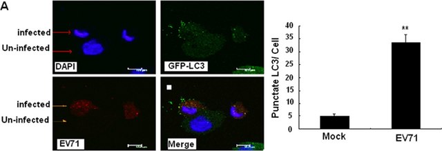 Anti-LC3B antibody produced in rabbit ~1&#160;mg/mL, affinity isolated antibody, buffered aqueous solution