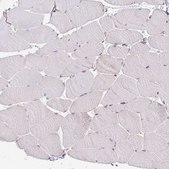 Anti-TNFRSF10A antibody produced in rabbit Prestige Antibodies® Powered by Atlas Antibodies, affinity isolated antibody, buffered aqueous glycerol solution