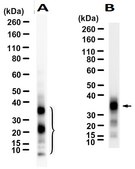Anti-POMC Antibody, clone 2J4 ZooMAb® Rabbit Monoclonal recombinant, expressed in HEK 293 cells