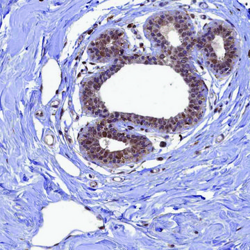 Anti-BRCA1 antibody produced in rabbit Prestige Antibodies&#174; Powered by Atlas Antibodies, affinity isolated antibody, buffered aqueous glycerol solution