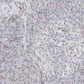 Anti-ECHDC2 antibody produced in rabbit Prestige Antibodies® Powered by Atlas Antibodies, affinity isolated antibody, buffered aqueous glycerol solution, Ab2