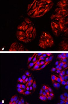 Anti-DPP4/CD26 antibody, Mouse monoclonal clone A6H, purified from hybridoma cell culture