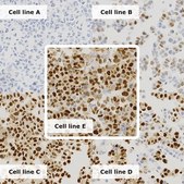 Breast Analyte ControlDR Cell line controls for immunohistochemistry and in situ hybridization