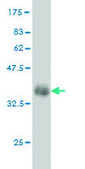 ANTI-FGR antibody produced in mouse clone 3B11, purified immunoglobulin, buffered aqueous solution