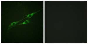 Anti-IL-13R antibody produced in rabbit affinity isolated antibody