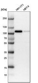 Anti-MCC antibody produced in rabbit Prestige Antibodies® Powered by Atlas Antibodies, affinity isolated antibody, buffered aqueous glycerol solution
