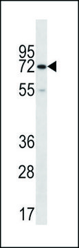 ANTI-CTPS2 (C-TERM) antibody produced in rabbit IgG fraction of antiserum, buffered aqueous solution