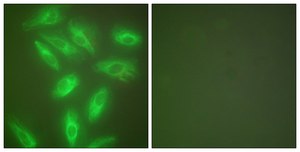 Anti-Keratin 18 antibody produced in rabbit affinity isolated antibody