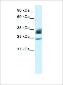 Anti-SIRT5 (AB2) antibody produced in rabbit IgG fraction of antiserum