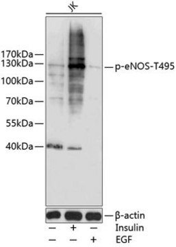 Anti-Phospho-eNOS-T495 antibody produced in rabbit