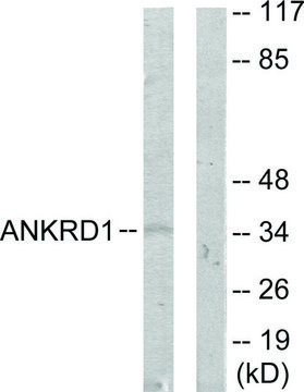 Anti-ANKRD1 antibody produced in rabbit affinity isolated antibody