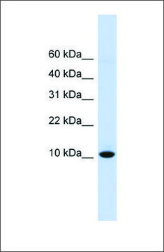 Anti-DDT antibody produced in rabbit affinity isolated antibody