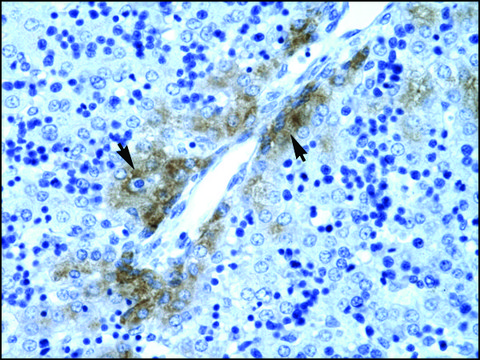 Anti-GATA3 antibody produced in rabbit affinity isolated antibody