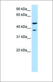 Anti-MAGEA3 antibody produced in rabbit affinity isolated antibody