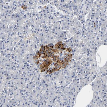 Anti-GNAS antibody produced in rabbit Prestige Antibodies&#174; Powered by Atlas Antibodies, affinity isolated antibody, buffered aqueous glycerol solution